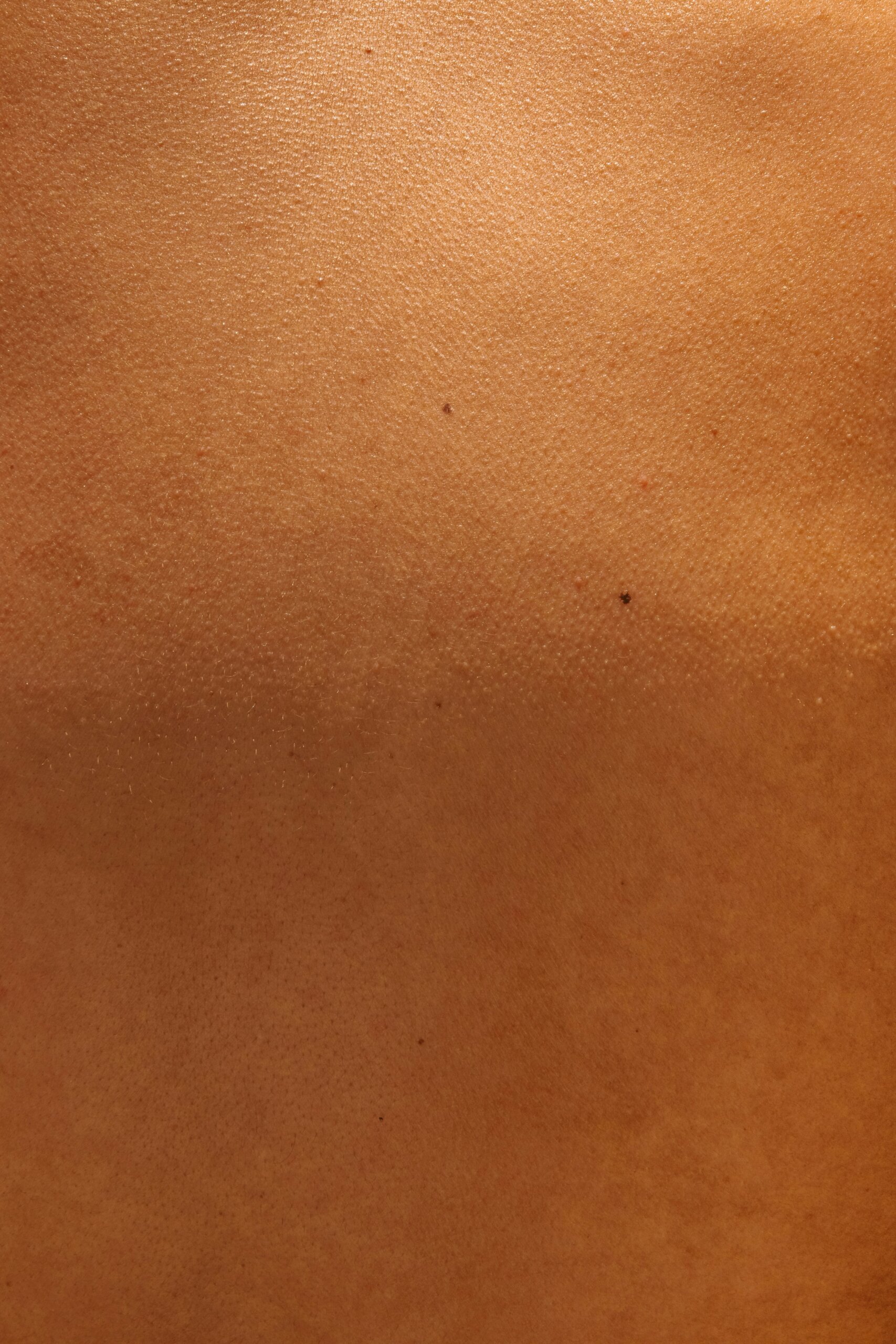 RECOVERYSKIN