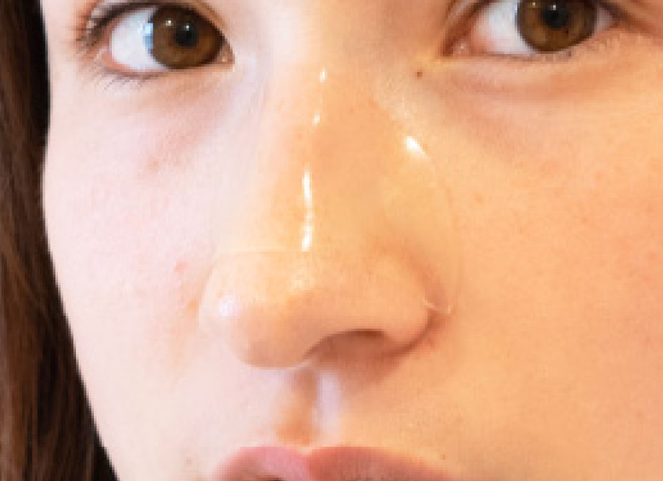 NOSEPOREPATCHES